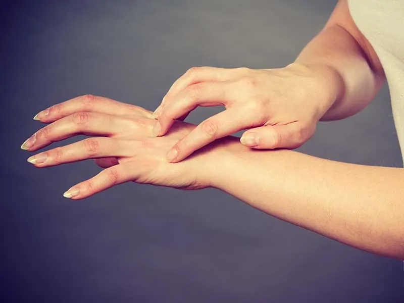 Три основни форми на дерматит на ръцете – лечение
