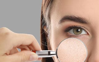 невродермит през зимата