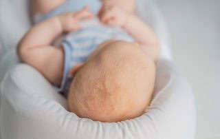 Себорея при деца