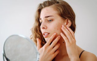 Слънчева алергия