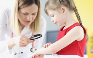 екзема при децата