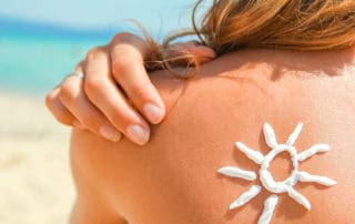 слънцезащита при екзема
