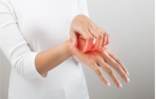 хронична екзема на ръцете