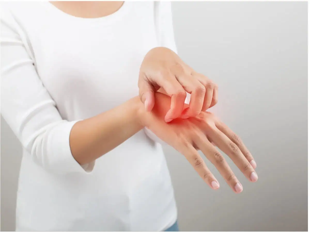 хронична екзема на ръцете