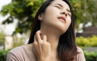 дерматит по лицето