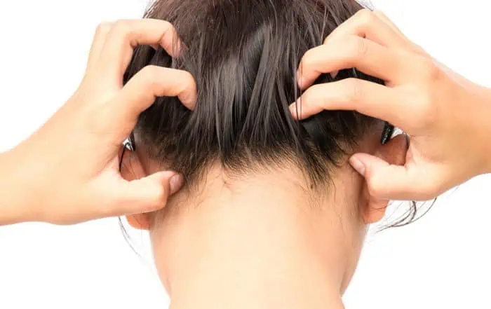 Имам сърбеж по главата