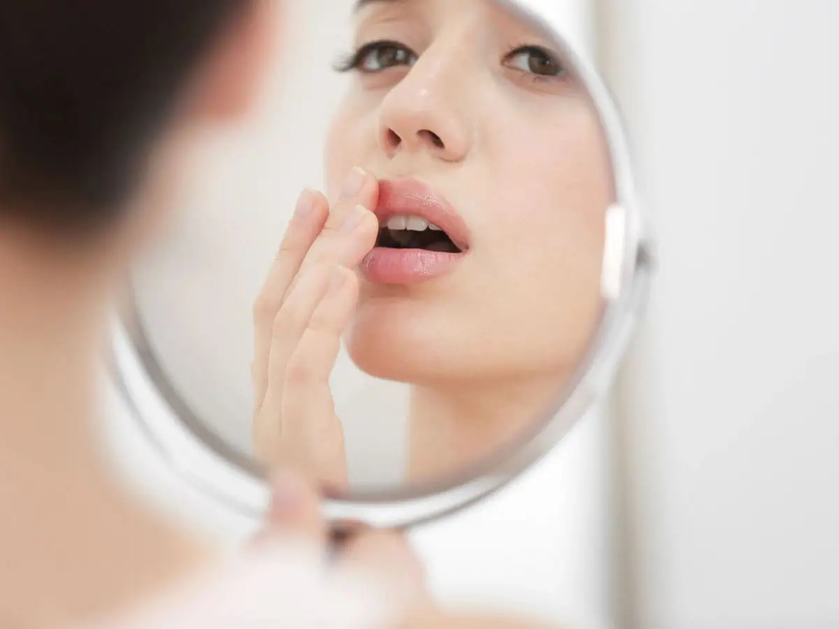 Подути устни