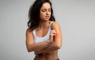 помощ при екзема