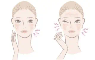 имам екзема по лицето