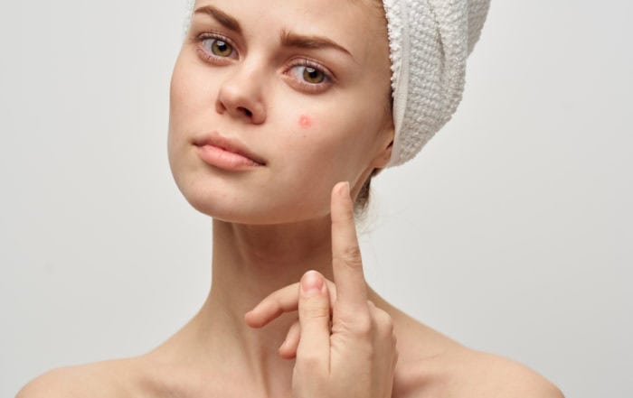 Себореен дерматит на лицето