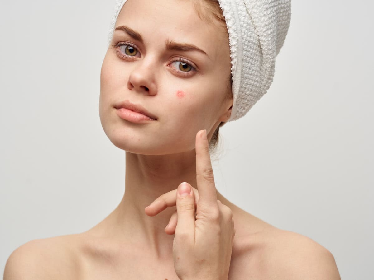 Себореен дерматит на лицето