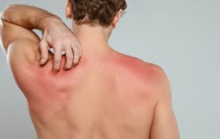 Сърбеж по кожата