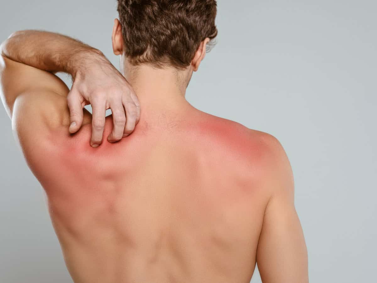 Сърбеж по кожата